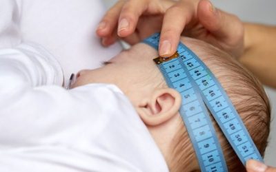 Chiropractic and Plagiocephaly