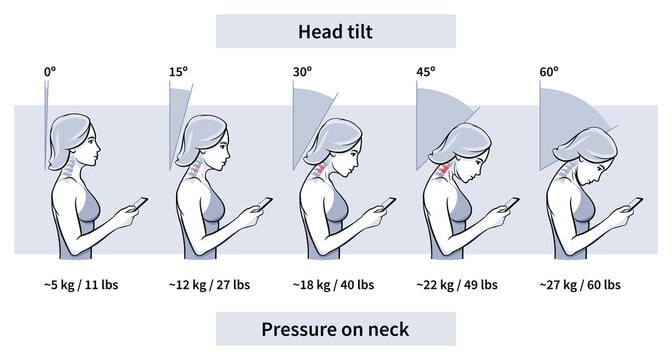 neck pain bayswater chiropractor